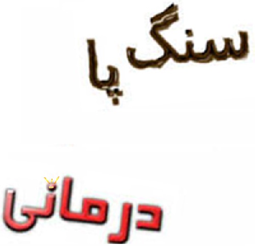 سنگ پا درمانی و سنگ پا شناسی